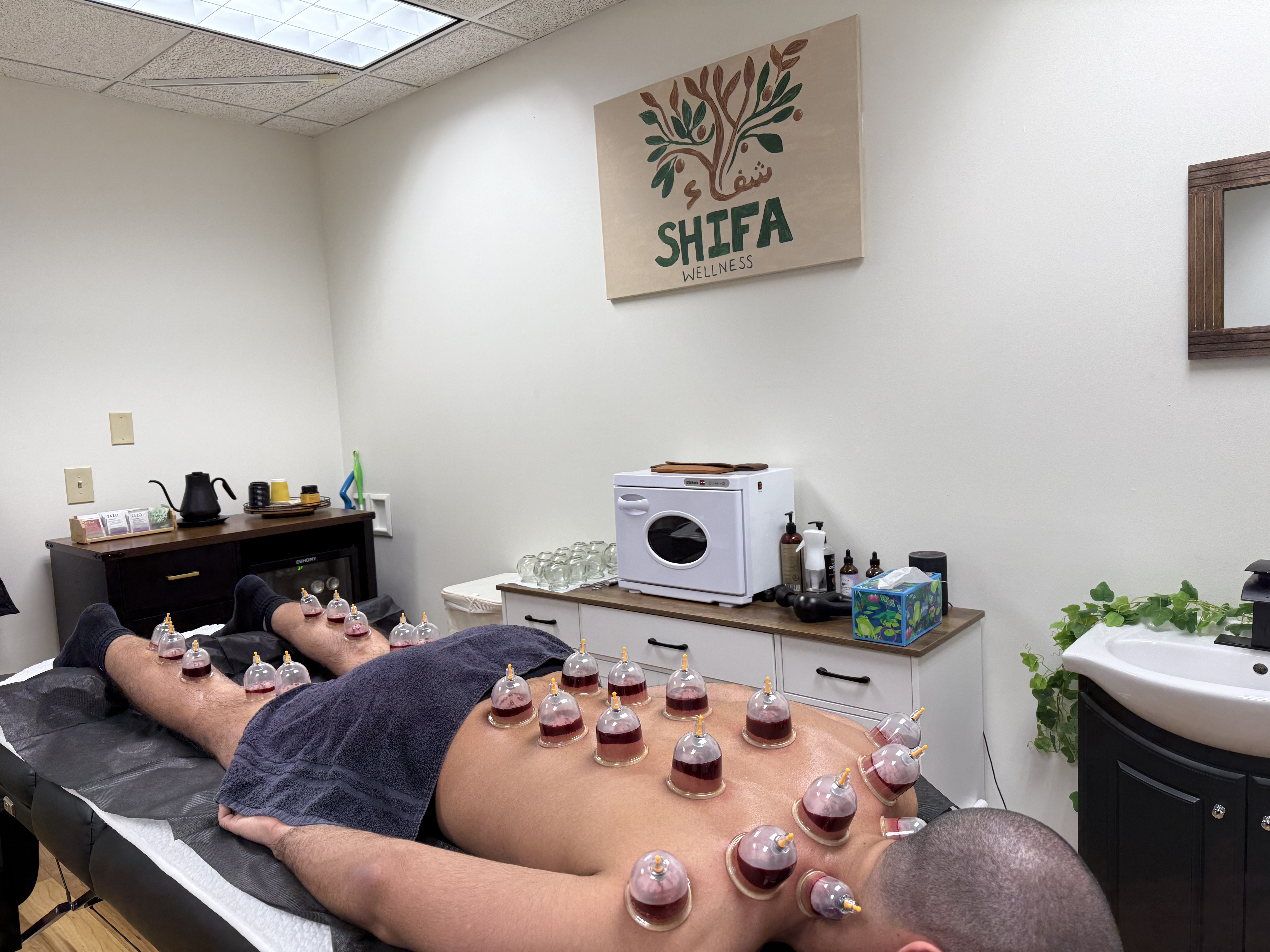 Hijama Wet Cupping